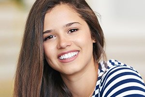 Lady wearing striped shirt smiling after teeth whitening
