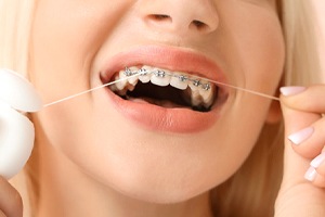 A woman uses dental floss to clean around her teeth while wearing braces